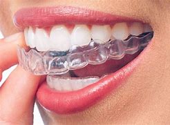 Invisalign Invisalign